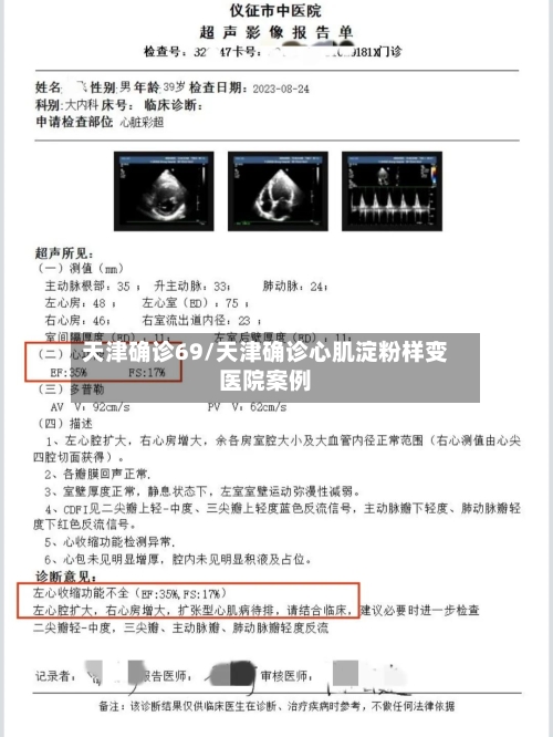 天津确诊69/天津确诊心肌淀粉样变医院案例