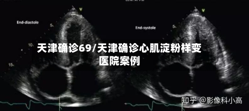 天津确诊69/天津确诊心肌淀粉样变医院案例-第2张图片