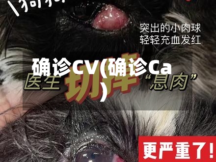 确诊CV(确诊Ca)-第2张图片