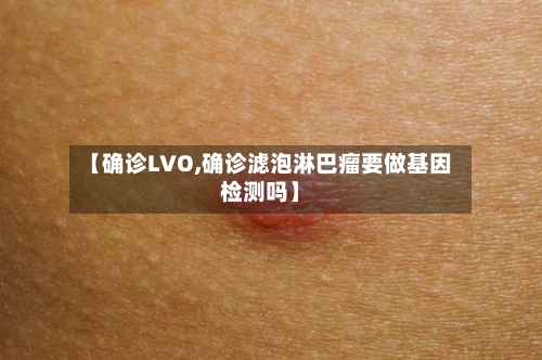 【确诊LVO,确诊滤泡淋巴瘤要做基因检测吗】-第3张图片