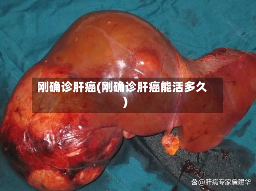 刚确诊肝癌(刚确诊肝癌能活多久)-第2张图片