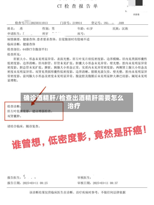 确诊酒精肝/检查出酒精肝需要怎么治疗-第3张图片