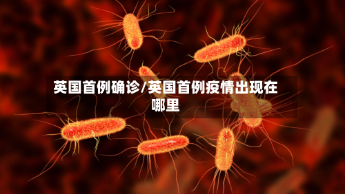 英国首例确诊/英国首例疫情出现在哪里