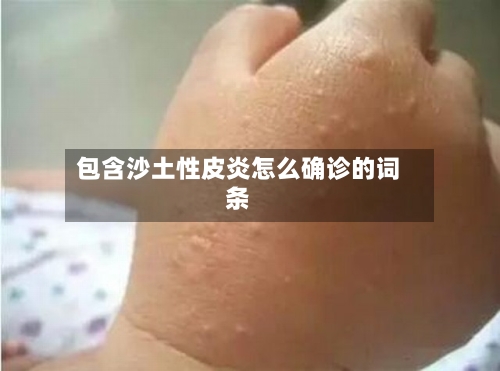包含沙土性皮炎怎么确诊的词条