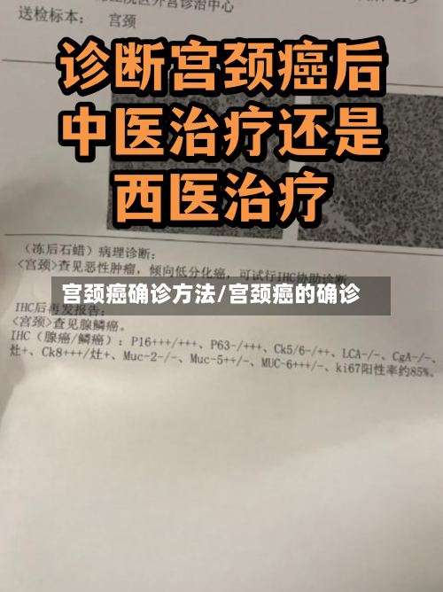 宫颈癌确诊方法/宫颈癌的确诊-第3张图片