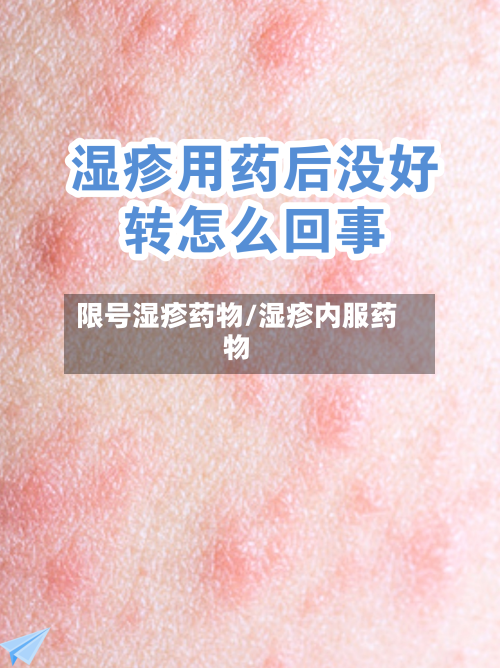 限号湿疹药物/湿疹内服药物