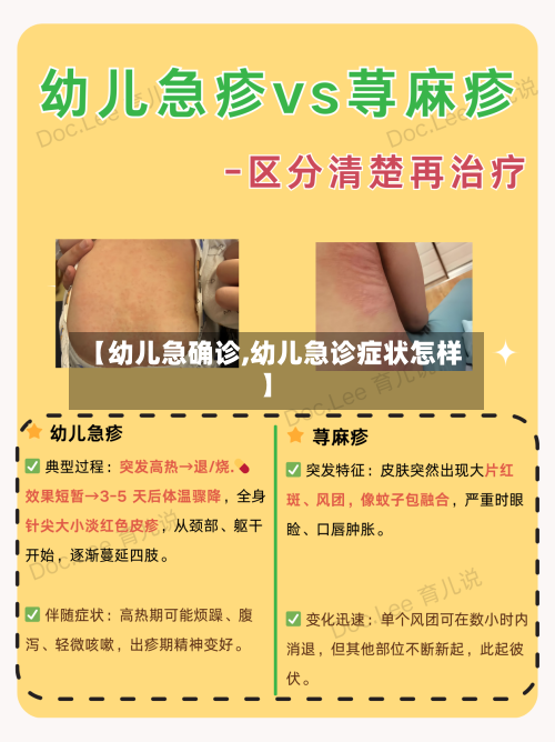 【幼儿急确诊,幼儿急诊症状怎样】