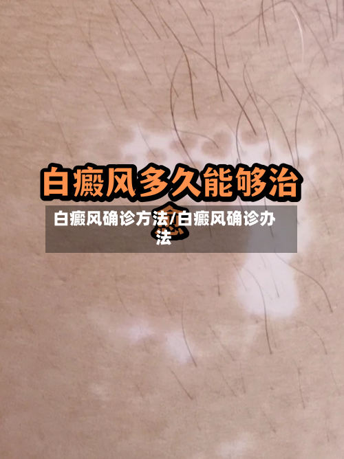 白癜风确诊方法/白癜风确诊办法-第2张图片