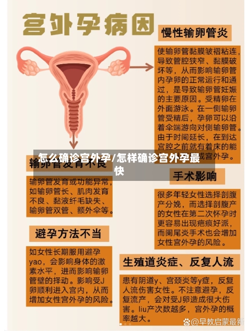 怎么确诊宫外孕/怎样确诊宫外孕最快-第2张图片