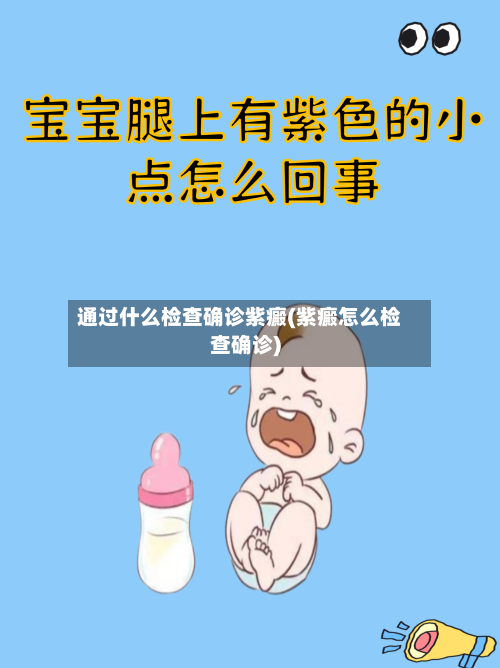 通过什么检查确诊紫癜(紫癜怎么检查确诊)-第2张图片