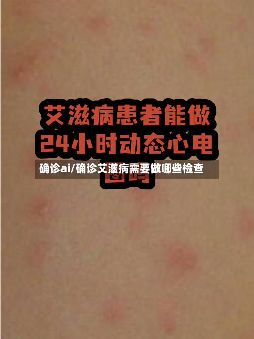 确诊ai/确诊艾滋病需要做哪些检查-第2张图片