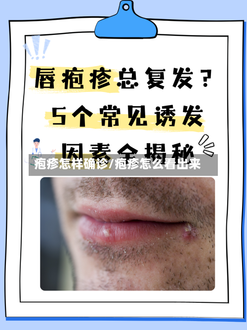 疱疹怎样确诊/疱疹怎么看出来-第2张图片