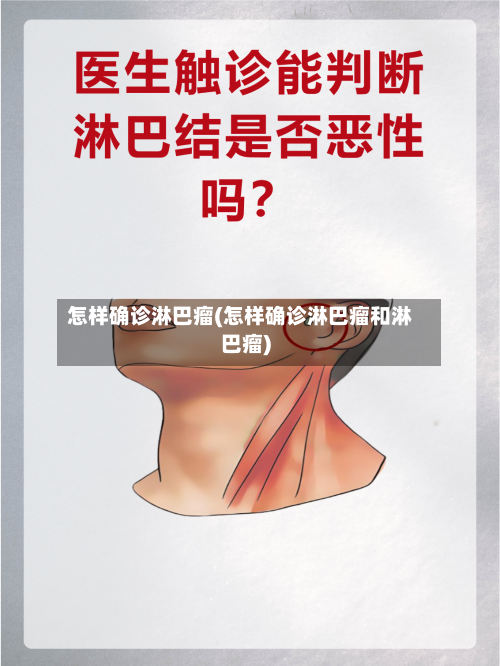 怎样确诊淋巴瘤(怎样确诊淋巴瘤和淋巴瘤)-第2张图片