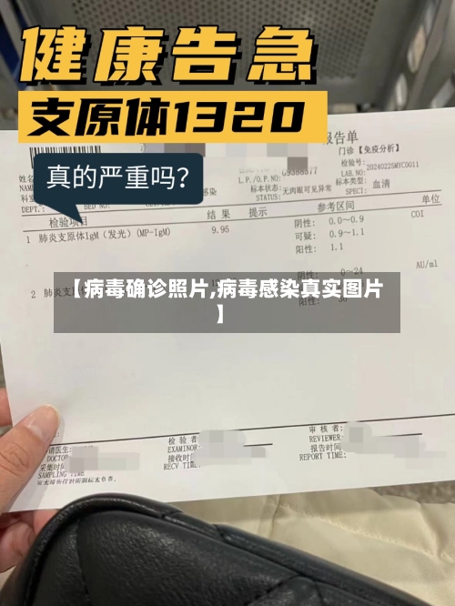 【病毒确诊照片,病毒感染真实图片】-第3张图片