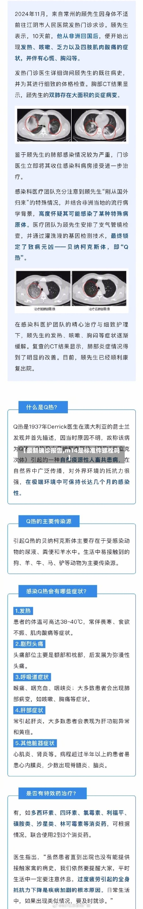 【最新确诊报告,m14是标准件螺栓吗】-第3张图片