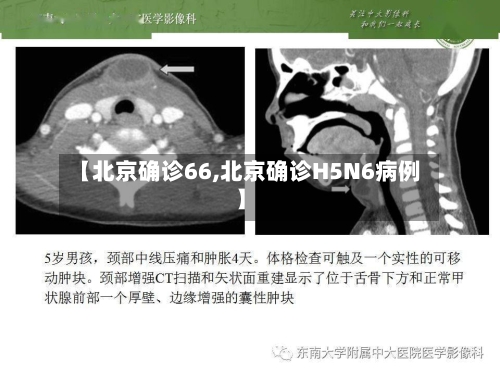 【北京确诊66,北京确诊H5N6病例】-第3张图片