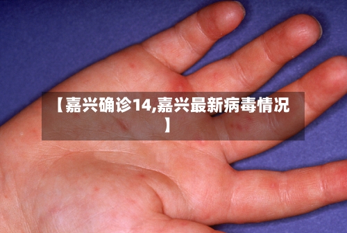 【嘉兴确诊14,嘉兴最新病毒情况】
