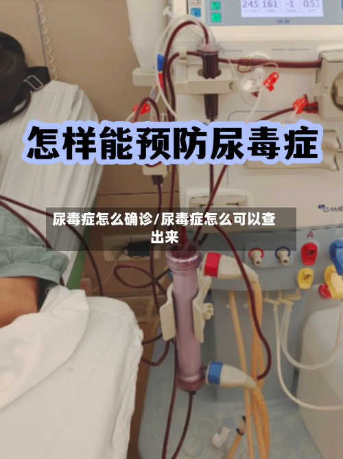 尿毒症怎么确诊/尿毒症怎么可以查出来-第2张图片