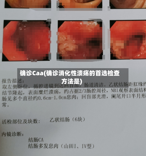 确诊Caa(确诊消化性溃疡的首选检查方法是)