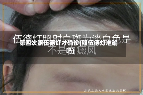 第四次照伍德灯才确诊(照伍德灯准确吗)-第2张图片