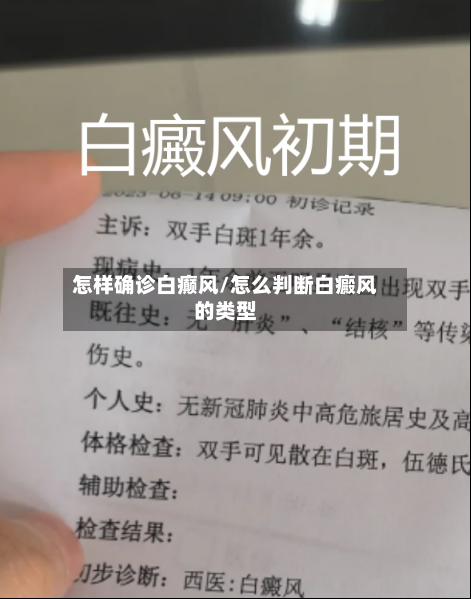 怎样确诊白癫风/怎么判断白癜风的类型-第2张图片
