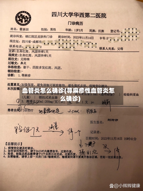 血管炎怎么确诊(荨麻疹性血管炎怎么确诊)-第2张图片