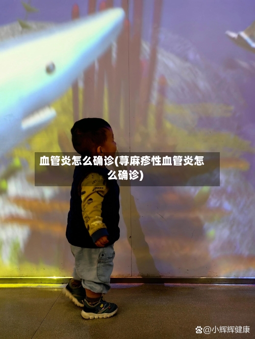 血管炎怎么确诊(荨麻疹性血管炎怎么确诊)