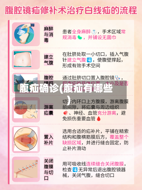 腹疝确诊(腹疝有哪些)-第2张图片