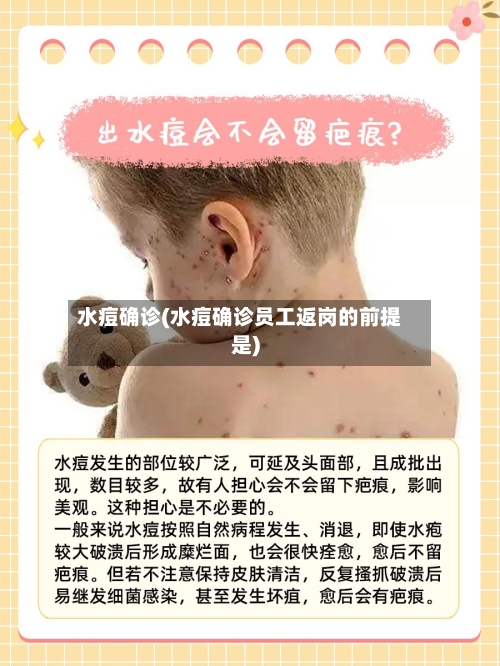 水痘确诊(水痘确诊员工返岗的前提是)