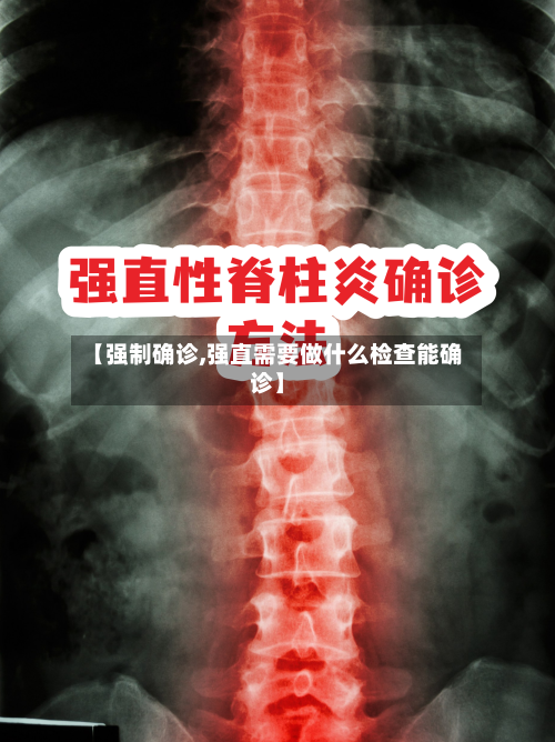 【强制确诊,强直需要做什么检查能确诊】