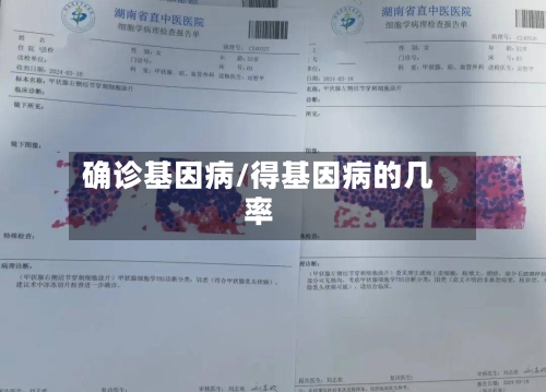 确诊基因病/得基因病的几率