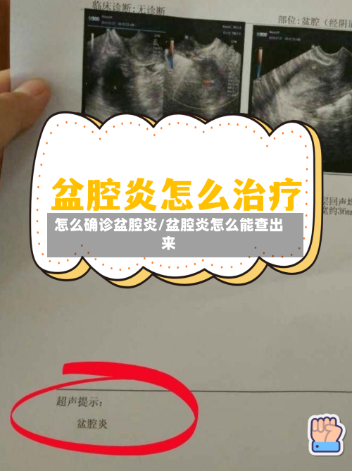 怎么确诊盆腔炎/盆腔炎怎么能查出来-第3张图片