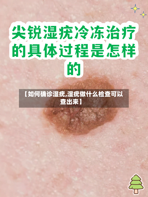 【如何确诊湿疣,湿疣做什么检查可以查出来】